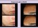 Allies Of Skin Azelaic & Kojic Advanced Clarifying Serum Сироватка освітлююча з азелаїновою кислотою ALS7 фото 5