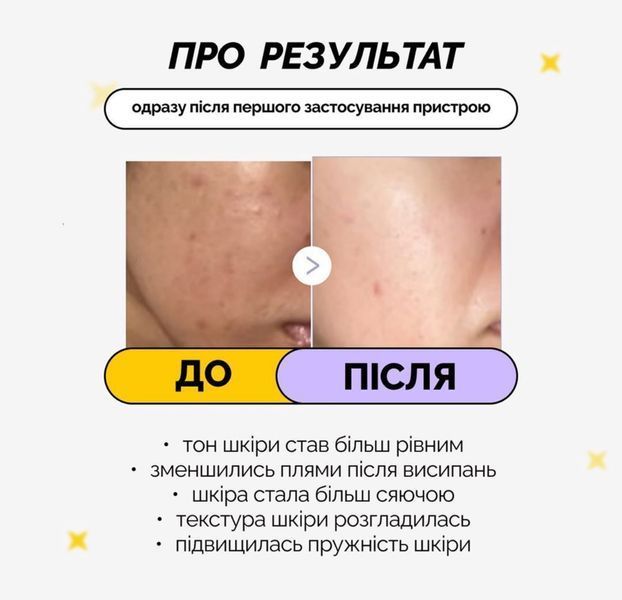 Medicube AGE-R Booster Pro Black Пристрій для електричного неінвазивного мікронідлінгу та звуження пор MDCB16 фото