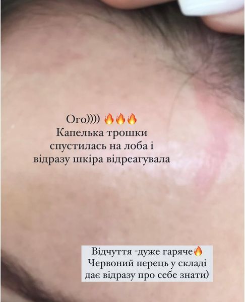 ORISING Hair loss System - Ампули інтенсивного догляду за волоссям ORSNG1 фото