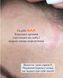 ORISING Hair loss System - Ампули інтенсивного догляду за волоссям ORSNG1 фото 8